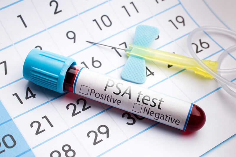 Bluttest ob PSA Wert erhöht ist, als Hinweis auf Prostatitis