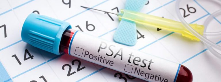 Erh hter PSA Wert Als Hinweis Auf Eine Prostatitis Prosturol 