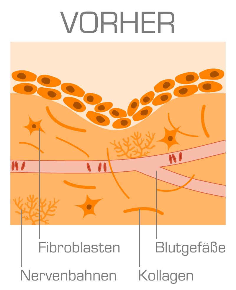 Sparflo prostatite