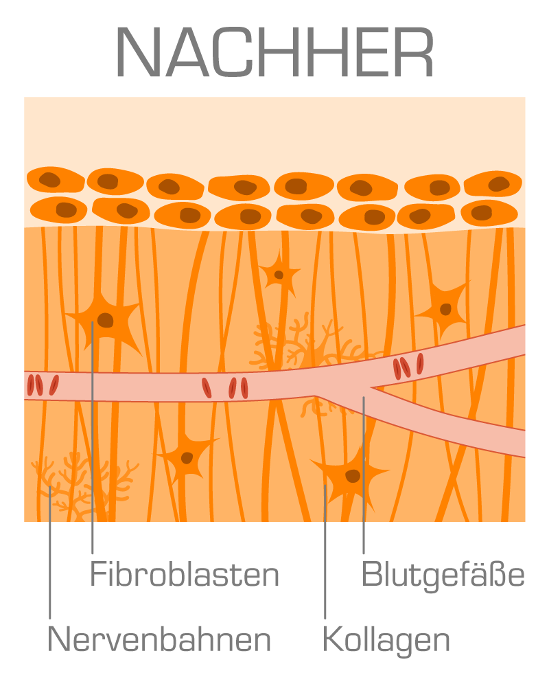 prostatitistherapie_nachher